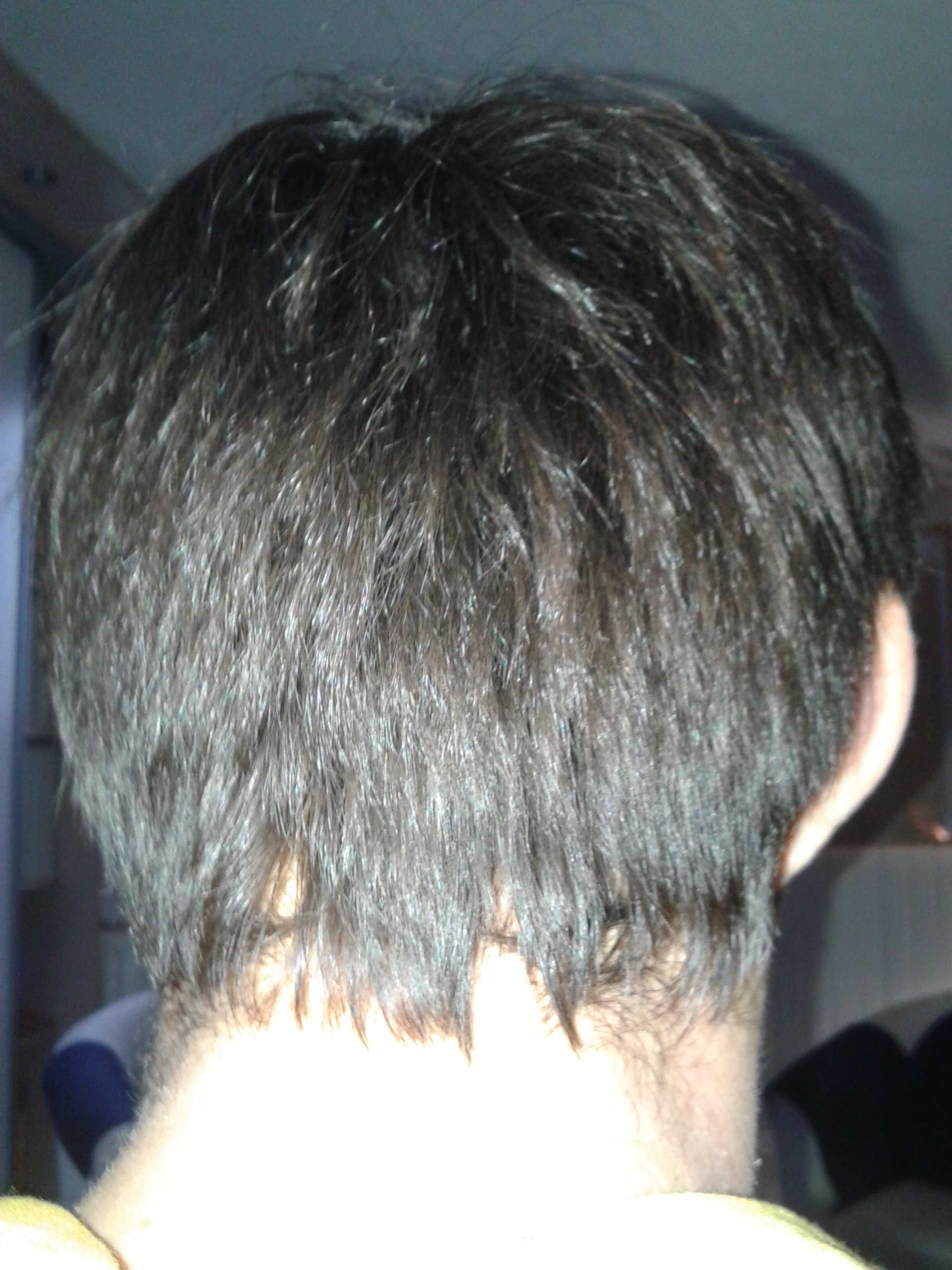 haargroei hersteld, haarprobleem opgelost, inhammen en witkleuring verholpen